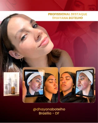 Cópia de Dhayana Botelho