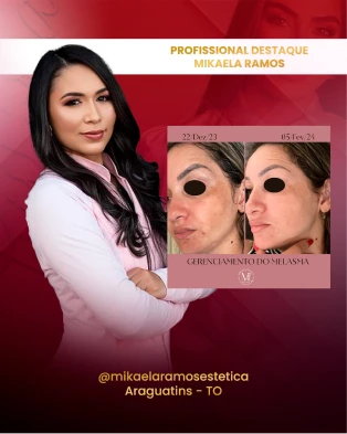 Cópia de mikaela