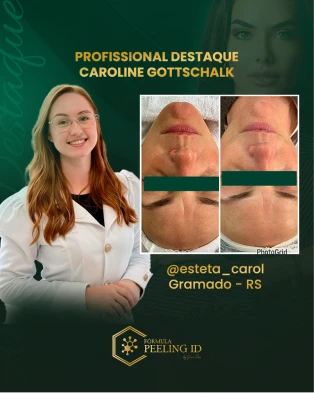 Feed 01 (6)